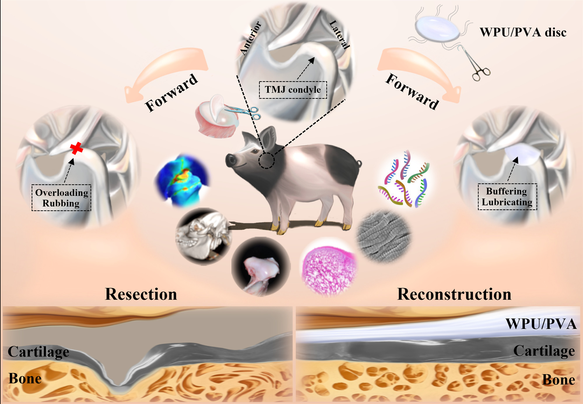 北大口腔贺洋团队实现人工颞下颌关节盘研发新突破